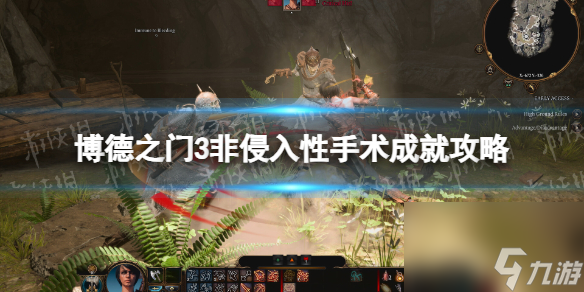 《博德之门3》非侵入性手术成就攻略 非侵入性手术怎么解锁？